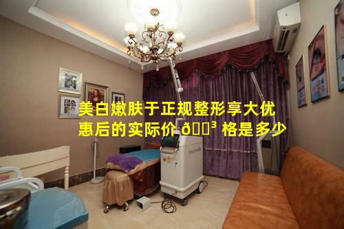 美白嫩肤于正规整形享大优惠后的实际价 🐳 格是多少